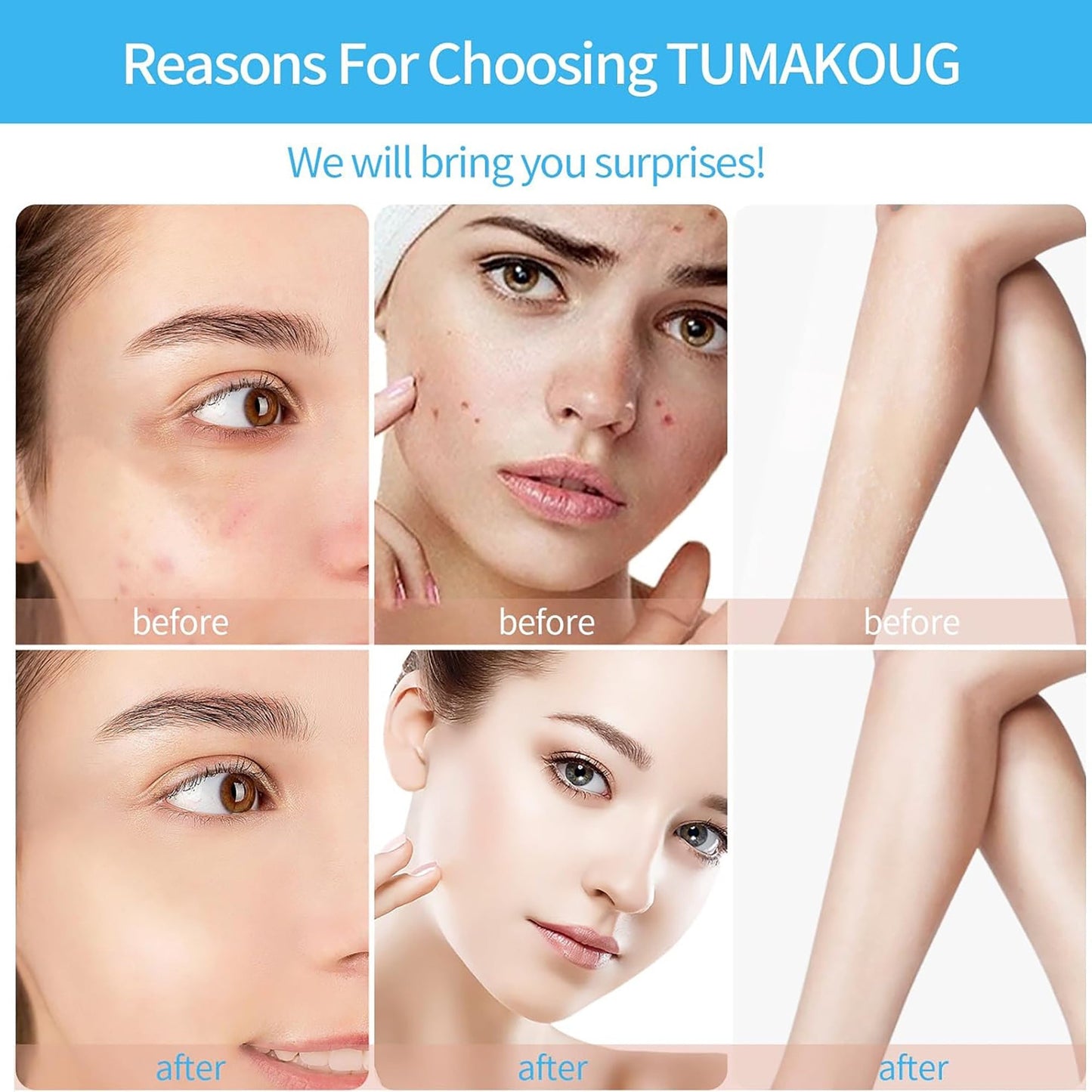 4-in-1 system displaying skin before and after results.