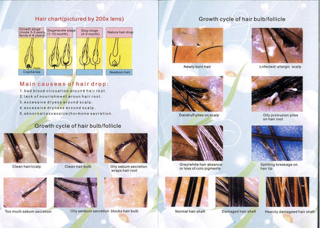 Fourth page of the manual for the SSW ML-911 Advanced Hair and Scalp Analyzer, offering troubleshooting tips and maintenance instructions.
