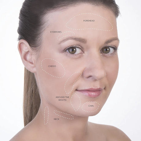 Image displaying places on face and neck you can use the NudeU Derma Roller.