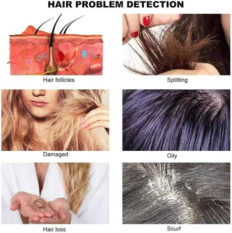 SSW M906 Hair and Scalp Analyzer displaying hair problem detection features, helping to identify issues like thinning and scalp irritation.