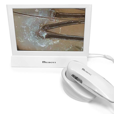 SSW M906 Hair and Scalp Analyzer displaying magnification, providing detailed analysis of hair and scalp health for personalized care.